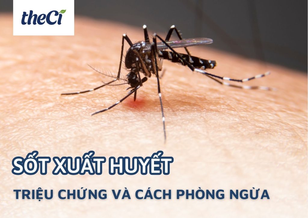 Sốt xuất huyết - Triệu chứng và cách phòng ngừa