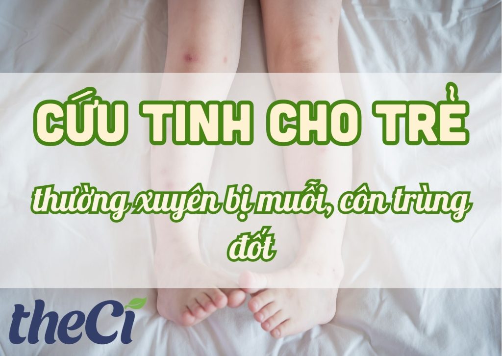 Cứu tinh cho trẻ thường xuyên bị muỗi, côn trùng đốt